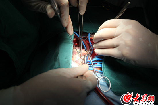 9:28������ǻ��(n��i)�İ���ǻ��ע��мˮ��ʹ���K����